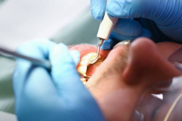 Best Emergency Root Canal Treatment in Great Neck Gardens, NY
