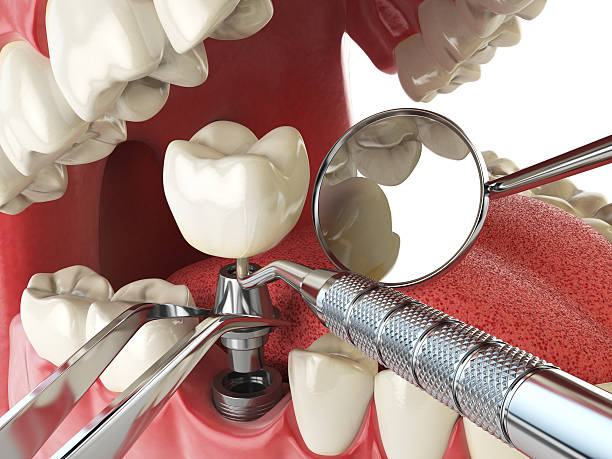 Best Emergency Tooth Extraction in Great Neck Gardens, NY